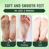 2 Paar Fußmaske, Feuchtigkeitsspendende Fussmaske, Socken Fußmaske für Trockene und