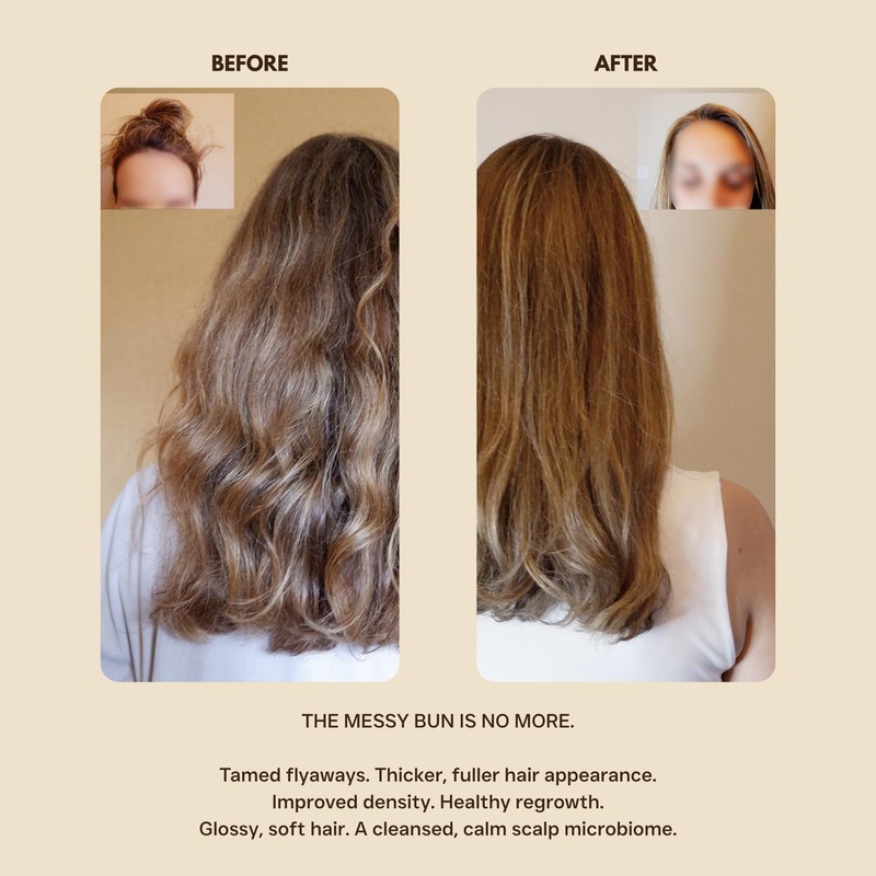 Maze Prenatal & Postpartum Shampoo & Conditioner Bundle 2 x