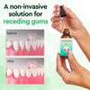 Gum Relief Drops, DentiZen Gum Regrowth Drops, Gum Treatment for