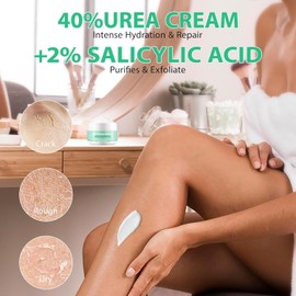 Urea Cream, Hand and Foot Hydration, 40% Dry Cracked Foot, Heels, Knees, Elbow and Hand Repairing Moisturizing Corn Exfoliating Urea Foot Urea Cream 100g (1 piece)