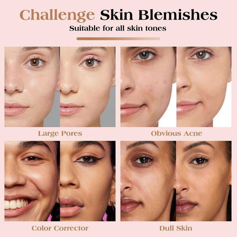 LOKFAR Concealer Full Coverage Kit with Brush, Under Eye Concealer