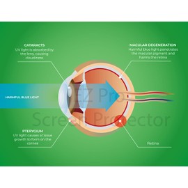 EZ-Pro Screen Protector Blue Light Tempered Glass Screen Protector for 15.6 Inches Laptop, 9H Hardness and Crystal Clear, Compatible with Any 15.6 inch Touch Screen Laptop