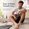Toenail Care Brace Stickers for Daily Wear – 2PCS Flexible