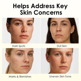 Relief Cream for Skin Barrier Support, Soothing & Nourishing Care for Blemish-Prone and Uneven Skin Tone with Arbutin, Tranexamic Acid & Niacinamide, Vegan Formula for Sensitive Skin, 1.69 fl oz