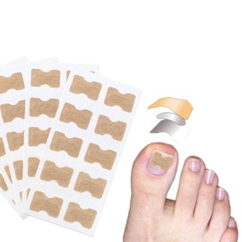 Cipszoely 50 PCS Ingrown Toenail Treatment, Painless Ingrown Toenail Corrector Nail Correction Patches Not Easy to Fall Off, Professional Safe Ingrowing Toenail Treatment for Ingrown Toenail Restoring