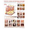 The Skin and Common Disorders Anatomical Chart