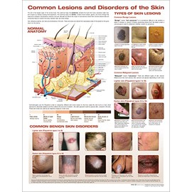 The Skin and Common Disorders Anatomical Chart