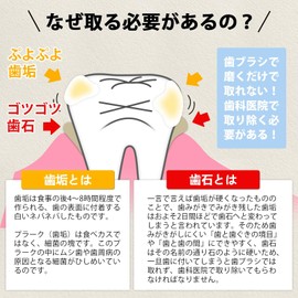 クリーニングキット 歯用ツール 自宅用 家族用 デンタルミラー スケーラー 舌ブラシ ステンレス鋼製 収納ケース付き 五点セット