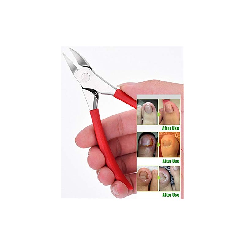 Toenail Clippers for Thick or Ingrown Toenails - YEESAM Precision