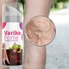 Variko Forte Gel V2 - Nourishing Gel with Valuable Ingredients