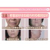 フェイシャルリフトアトワンスαビギナーズセット＋フェイシャルローラー