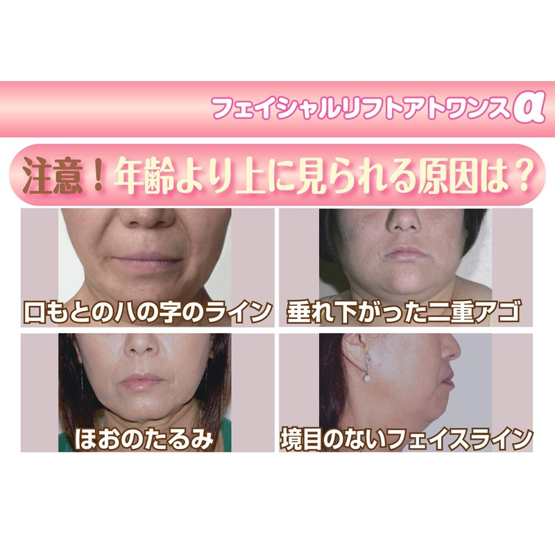 フェイシャルリフトアトワンスαビギナーズセット＋フェイシャルローラー