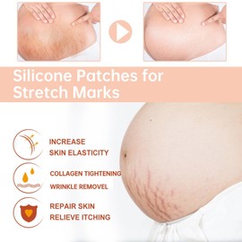 Silicone Patches for Stretch Marks, Anti Wrinkle Stretch Removal Sheet for Pregnant Women, Washable Reusable Skin Lifting & Tightening Silicone Tummy Sticker Belly Stickers Stretch Marks Pad (1pc)