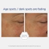 Neostrata Skin Active Firming Retinol Repair Complex [30 Ml