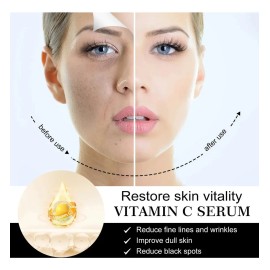 Mopoyat - Srum Facial Con Vitamina C, Hidrata Y Nutre La Piel, Srum Con Vitamina C, Srum Facial Antienvejecimiento Y Antiarrugas - 2 Unidades         