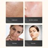 Facial Oxygen Injector Fine Mist Deep Moisturizing High Pressure Handheld
