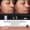 Suero Lifting Facial Inmediato Y Progresivo Tensor Facial Momento de