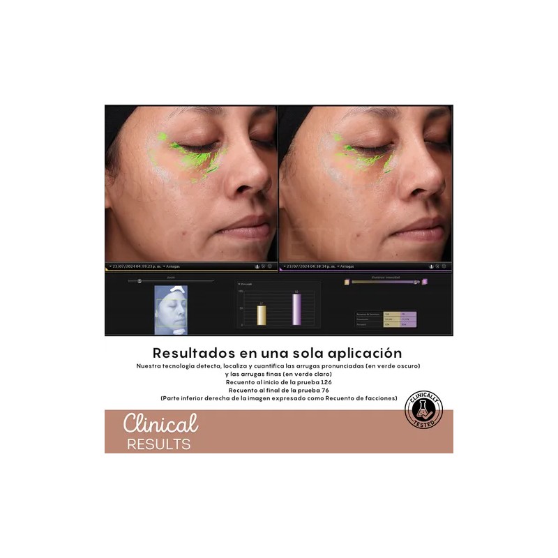 Suero Lifting Facial Inmediato Y Progresivo Tensor Facial Momento de