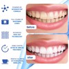 DENTELO Teeth Whitening Strips- Mint Flavor, Zero Sensitivity, Enamel Safe,