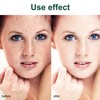 Pack of 2 Whitening Freckle Cream, Anti-Hyperpigmentation Skin Brightening Cream,