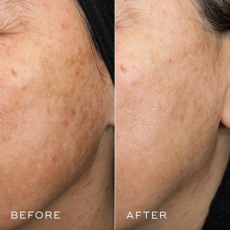 Medik8 Crystal Retinal 6 - Anti-Ageing Retinol Cream for Radiant