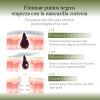 3 Piezas Oxyglow Acne Loción Secante Noche Cuidado Facial Mixta