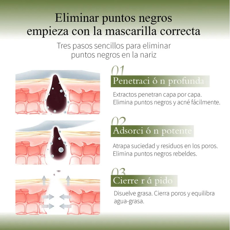 3 Piezas Oxyglow Acne Loción Secante Noche Cuidado Facial Mixta