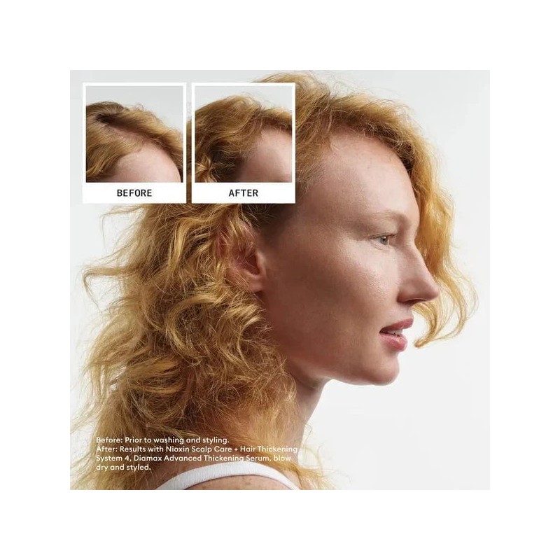 Nioxin Scalp + Hair Thickening System 4 Trial Kit