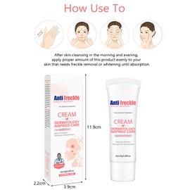 Sommersprossen Creme, Aufhellende Creme, 0,7 Unzen Nicotinamid Sommersprossenentfernungscreme Gesichtsaufhellende feuchtigkeitsspendende nährende reparierende Sommersprossencreme