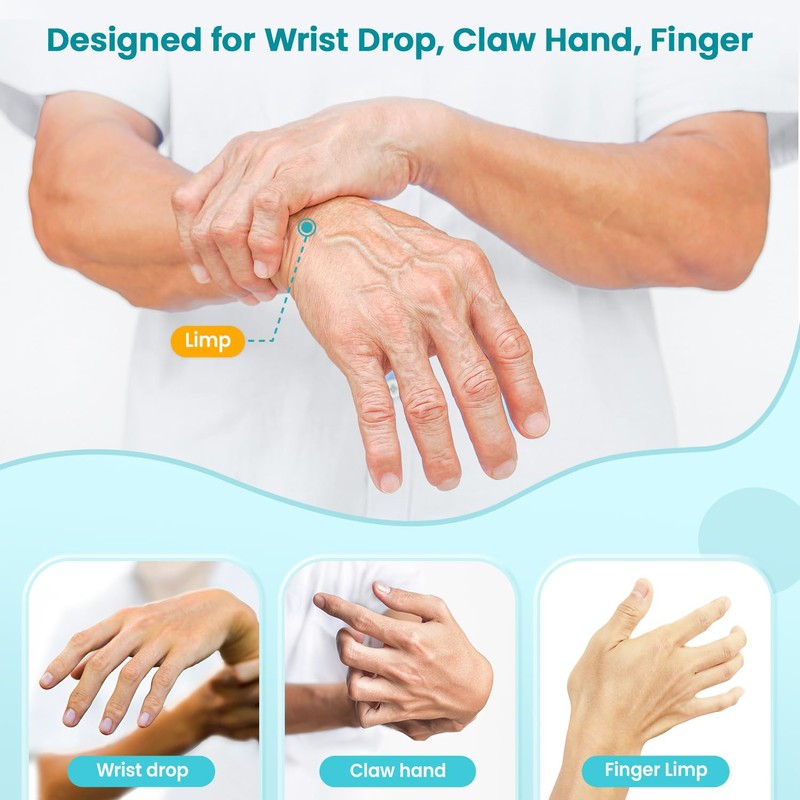Radial Nerve Palsy Splint Brace for Wrist drop, 5 Fingers