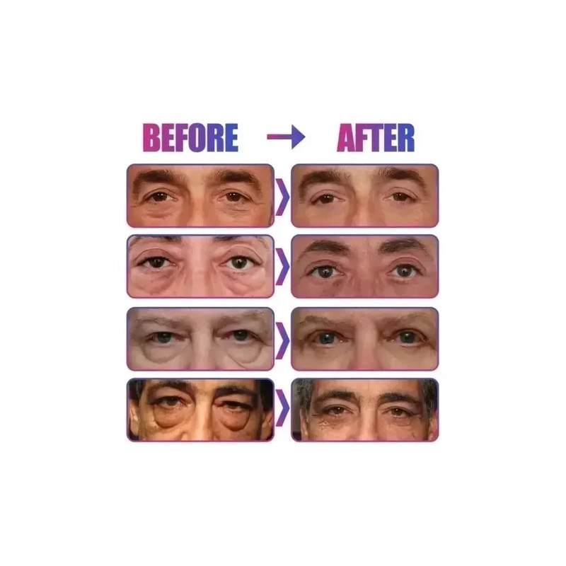 Tratamiento Facial P Manchas Arrugas Ojeras Vc Antiedad 30ml