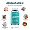Only The Best Multi Collagen Complex with Types I II