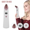 Electric Blackhead Remover Facial Acne Comedo Extractor Rechargeable Blackhead Suction