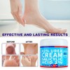 Ebanel Urea Cream 42% Plus Salicylic Acid 4.6 Oz, Callus