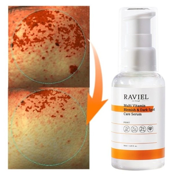 Vitamin C 3-Day Blemish 17.4% Pure Tone-Up Serum Blemish Farewell