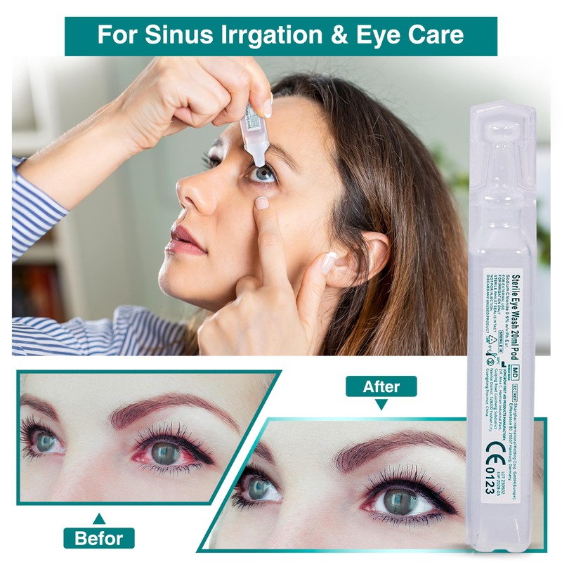 General Medi Eye Wash - Sterile Saline Solution 20ml/0.9% (Pack