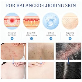 Crema para el cuidado de la foliculitis para el cuerpo y el cuero cabelludo, fórmula para protuberancias de afeitar, pelos encarnados y protuberancias