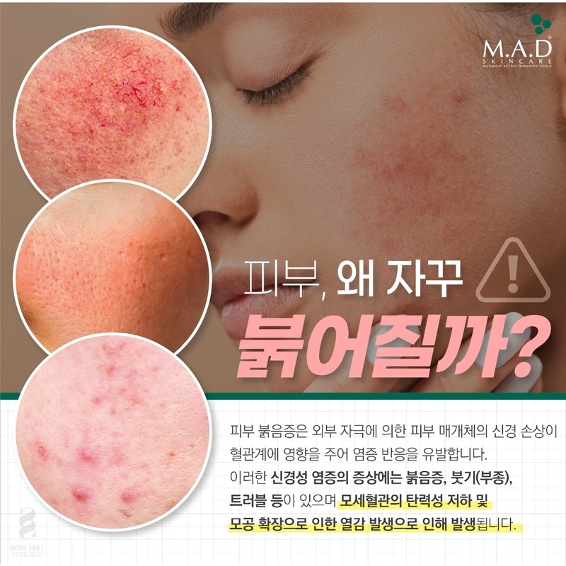 Madskin Redness Rescue Serum 120ml Heat pore trouble soothing rescue