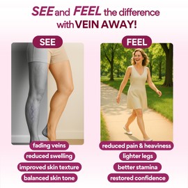 VoomVaya Vein Away – Varicose Veins Treatment for Legs for Women Over 40 – Circulation Supplements Supports Healthy Vein & Reduces Spider Veins – Hawthorne Berry, Butcher’s Broom & Diosmin – 60 Caps
