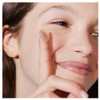 Skin Control Pimple Patch AM 24 Patches
