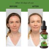 Relaxcation Moringa Oil – Cold Pressed from Moringa Oleifera Seeds,