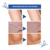 Cicatrizes Gel Reparador De Cicatrizes Fade Scars