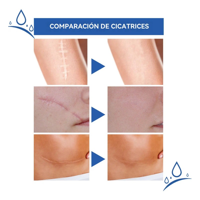 Cicatrizes Gel Reparador De Cicatrizes Fade Scars