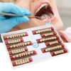 Resin Tooth Acrylic Resin Denture Teeth Dental Resin False Teeth