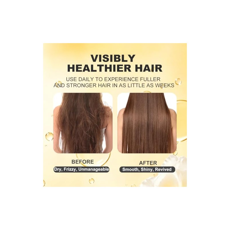L'Oréal Paris Ever Curl Acondicionador Rizos Definidos Aceite Coco, 250