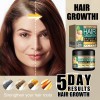 Crema Capilar De Jengibre Para El Crecimiento Del Cabello