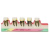 Dental Teeth Model Ceramic Clear Structure Oral Care Educational Periodontal