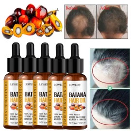 LEWEDO 5X Organic Batana Oil Serum for Hair Growth Improves Scalp Health Anti-Hair Loss