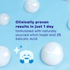 Clean & Clear Advantage Acne Spot Treatment, Unisex, 0.75 oz