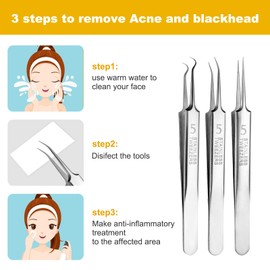 Pimple Blackhead Remover 3-Piece Tweezers Face Nose Black Head Precise Professional Face Extraction Set Pore Impurities Sharpener Needle Clip Scraper Make Up Tool Set